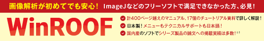 Text Mining Studio（テキストマイニングスタジオ）
